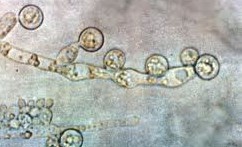 Candida, yeast